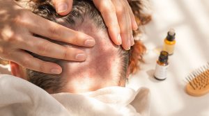 découvrez les principales causes d’un cuir chevelu douloureux au toucher et nos conseils pratiques pour soulager l’inconfort. obtenez des solutions adaptées pour prendre soin de votre cuir chevelu.