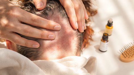 découvrez les principales causes d’un cuir chevelu douloureux au toucher et nos conseils pratiques pour soulager l’inconfort. obtenez des solutions adaptées pour prendre soin de votre cuir chevelu.