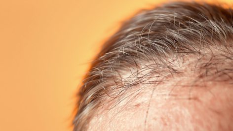 découvrez quelle est la vitesse moyenne de pousse des cheveux par mois, les facteurs qui l'influencent et des conseils pour stimuler leur croissance naturellement.