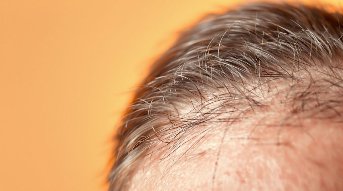 découvrez quelle est la vitesse moyenne de pousse des cheveux par mois, les facteurs qui l'influencent et des conseils pour stimuler leur croissance naturellement.